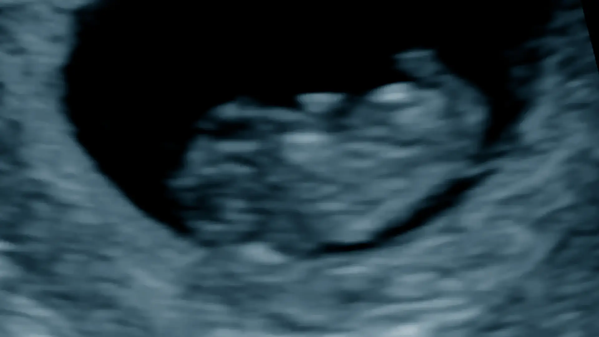 Early Pregnancy Scan - The Ultrasound Suite