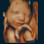 3D Pregnancy Ultrasound Scan