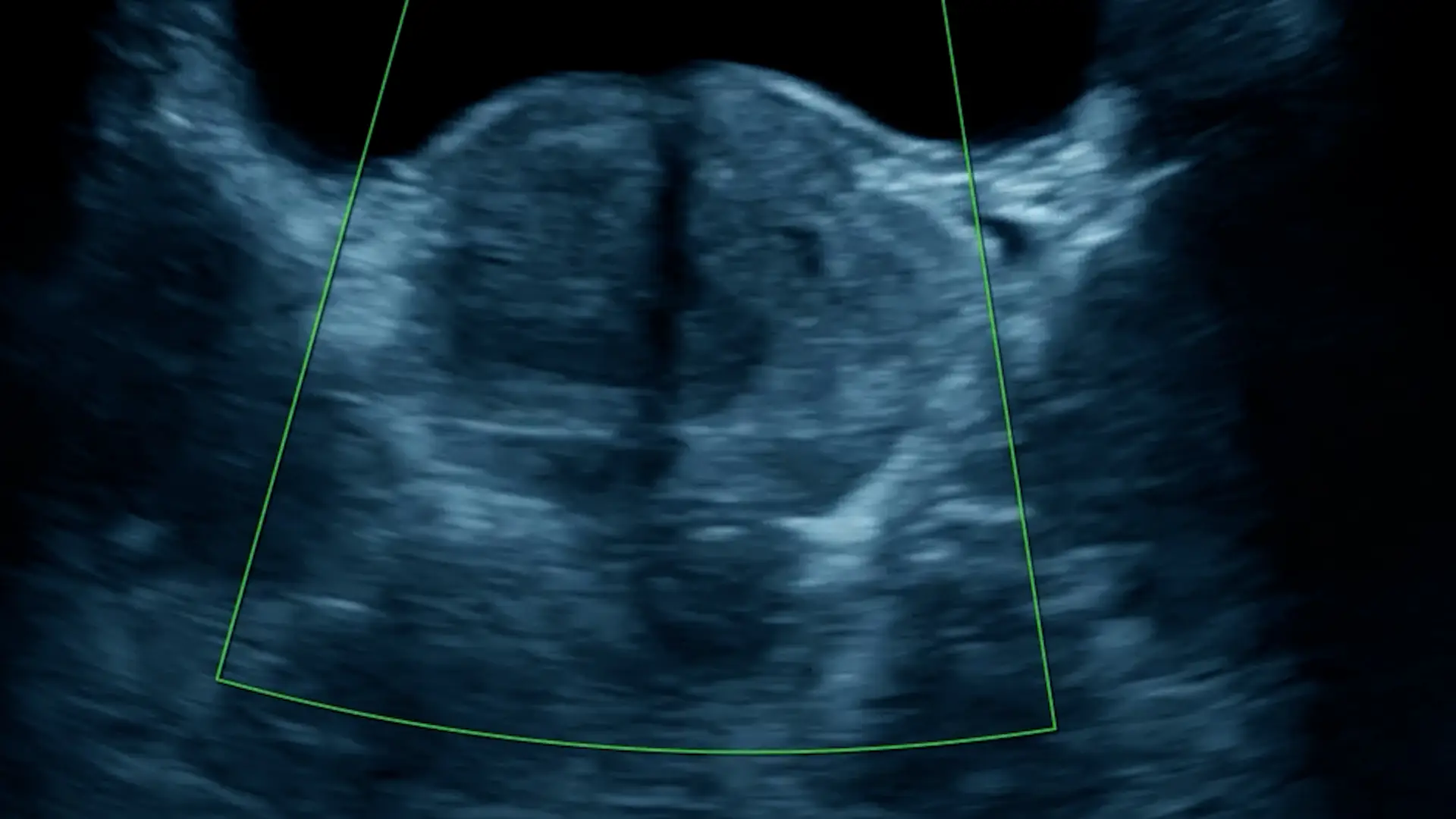 Male Pelvic Ultrasound - The Ultrasound Suite